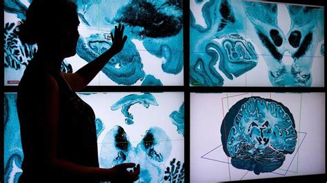 McGill gets $4 million for intellectual disabilities research ...