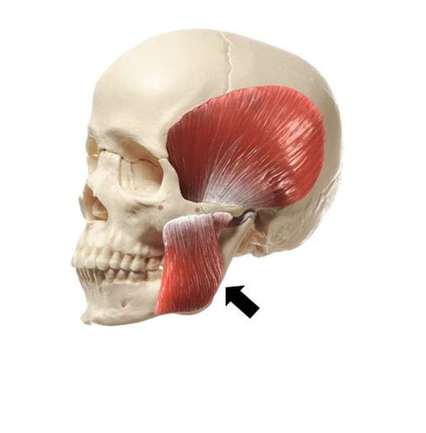 Image result for Masseter Muscle Trigger Point