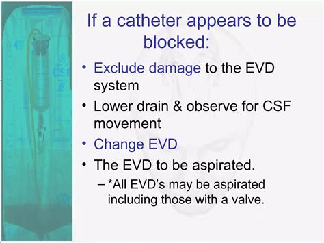 External Ventricular Drain | PPT