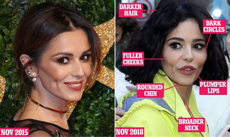 Pregnant Swollen Face