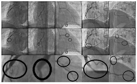 High-Dimensional Feature Selection for Automatic Classification of ...