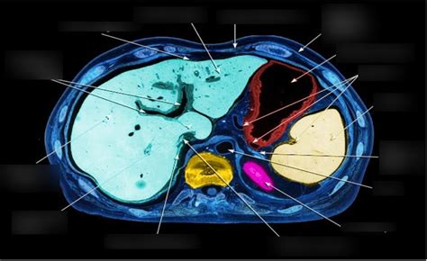 Image result for Hida Scan Explained