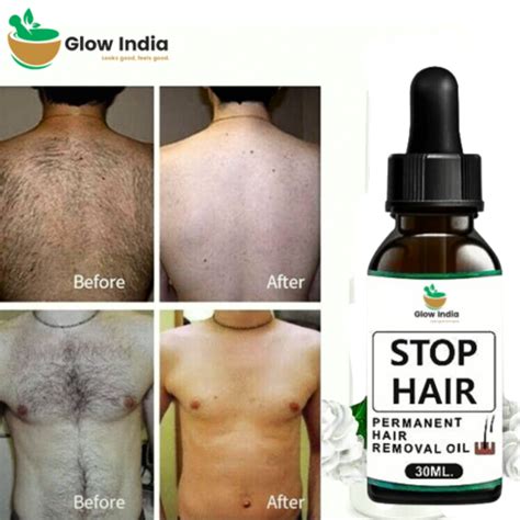 🔥100% Original🔥Permanent Hair Removal Oil For Men And Women| No Side E ...