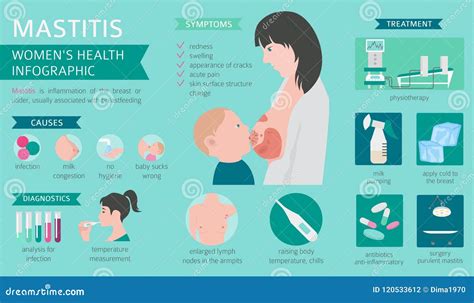 Mastitis, Breastfeed, Medical Infographic. Diagnostics, Symptoms Stock Vector - Illustration of ...