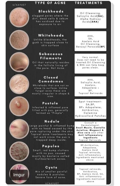 Quick tips 5 ways to treat an underarm cyst – Artofit