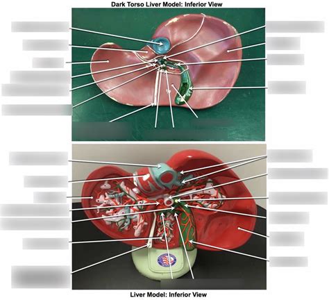 Image result for Liver Models Labeled