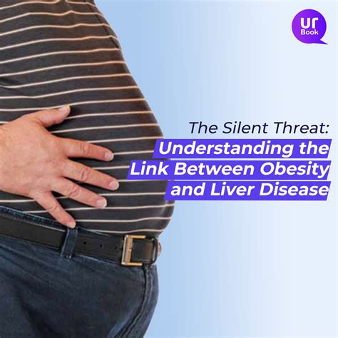 Fatty Liver Disease, Its Link With Obesity, And Prevention