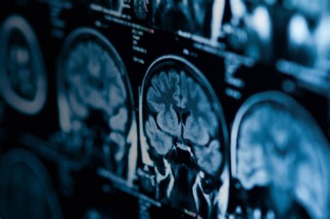 Healthcare & Life Sciences Information Technology (IT) Solutions | HPE ...