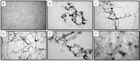 Chitosan Oligosaccharides Inhibit/Disaggregate Fibrils and Attenuate ...