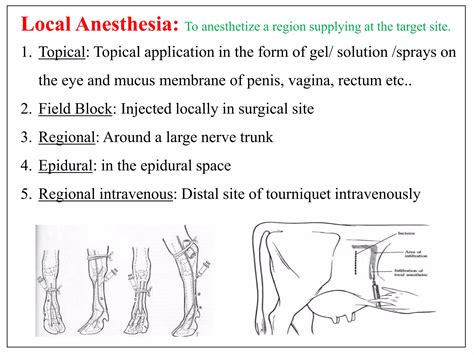 Extraoral Technique of Local Anesthesia 的图像结果