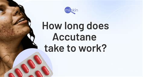 Accutane (isotretinoin): All you need to know