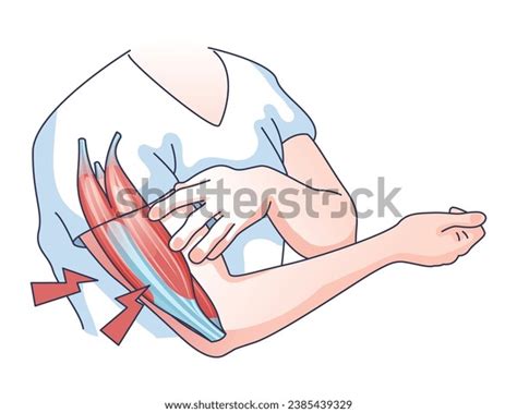 Exercise Weak 的图像结果