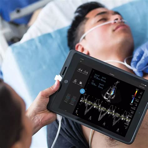 Point of care ultrasound - Philips