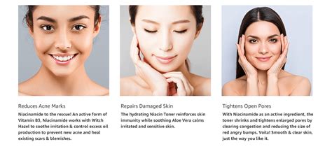 Foxy.in : Buy mamaearth Niacin Toner For Face, with Niacinamide & Witch ...