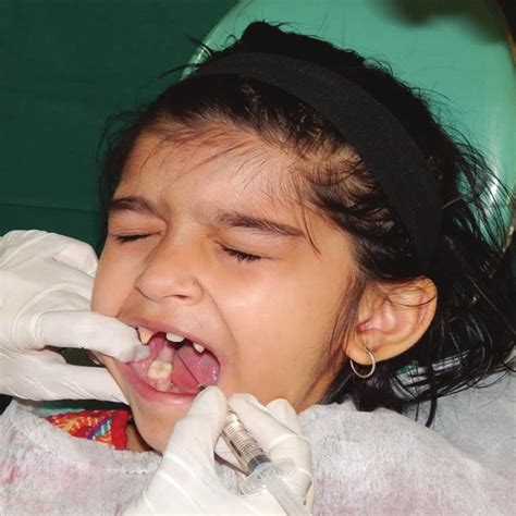 Administration of Local Anesthesia 的图像结果