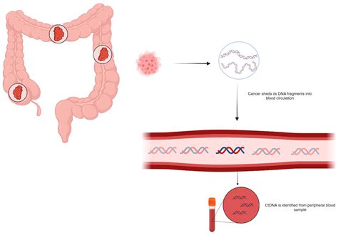 Circulating Tumor DNA Testing for Minimal Residual Disease and Its ...