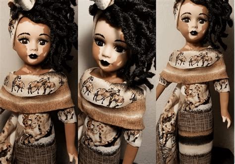 Dolls with vitiligo are being created to teach kids beauty comes in ...