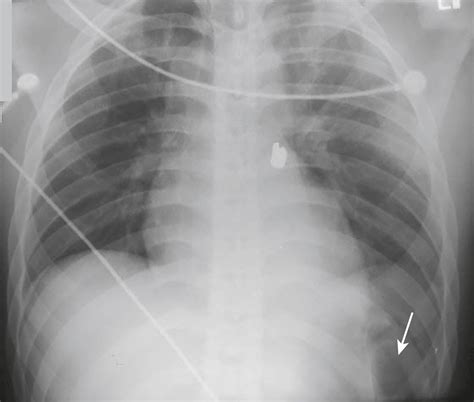 Diagnostic Radiology Signs - Clinical Tree