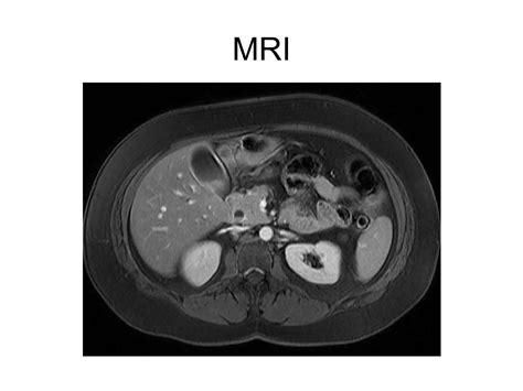 Anatomy of gall bladder | PPTX