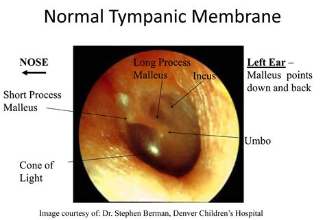 Tympanic Membrane Anatomy at Alexander Feakes blog