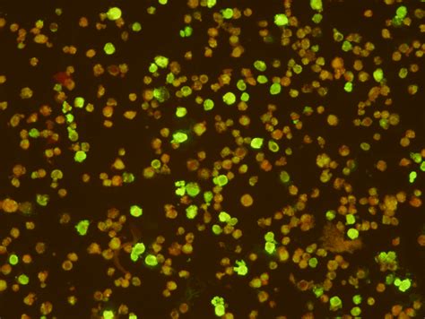 Scimedx IFA Viral Assays — Scimedx Corporation