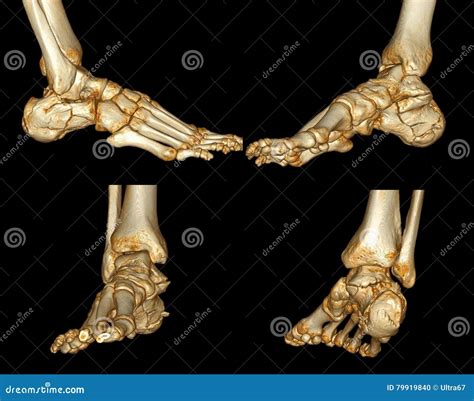 Human foot scan stock illustration. Illustration of foot - 79919840