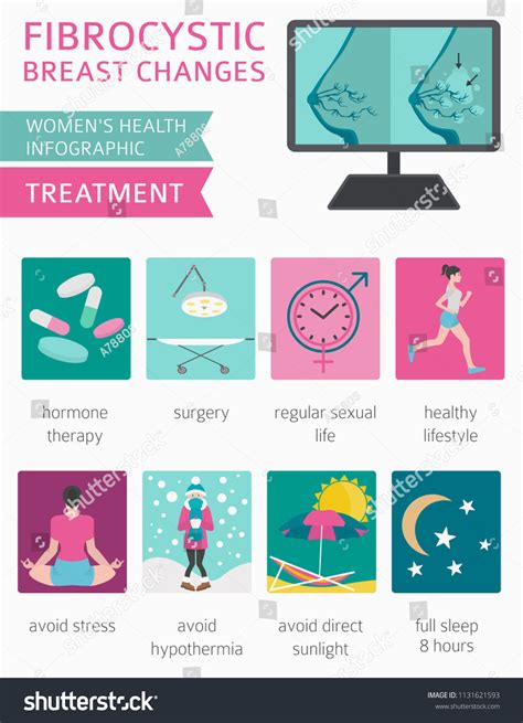 Fibrocystic Breast Changes Disease Medical Infographic: vector de stock (libre de regalías ...