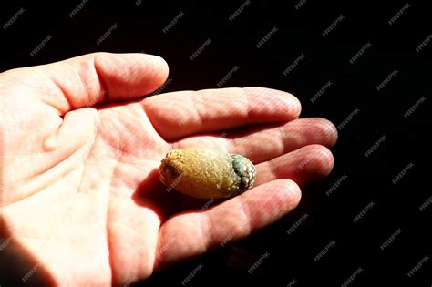 Premium Photo | Gallstone disease cholelithiasis the formation of stones stones in the ...