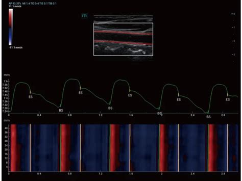 Resona A20 - Premium Ultrasound System for Radiology - Mindray India