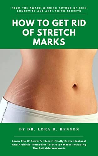 How To Get Rid Of Stretch Marks: Learn the 12 Powerful Scientifically ...