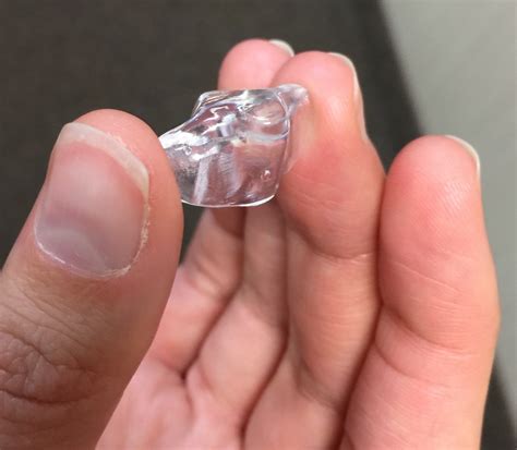 NTI Appliance: How does a NTI Night Guard Work for Migraines and TMJ?