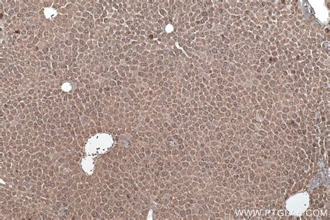 IHCeasy ADH6 Ready-To-Use IHC Kit KHC0539 | Proteintech