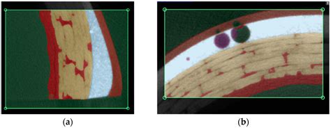 Investigation of the Causes of Premature Rain Erosion Evolution in ...