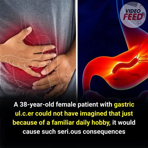 Doctors Warn: Dangerous Eating Habits Behind Painful Stomach Ulcers