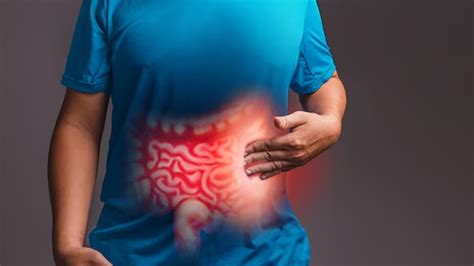 Doctor Shares Signs, Causes, Treatment Of Inguinal Hernia | OnlyMyHealth