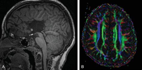 Brain Malformations - Clinical Tree
