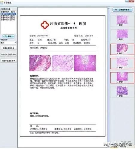 北京顺义6名病例行踪轨迹公布 他们都去了哪里？一图看懂-千龙网·中国首都网