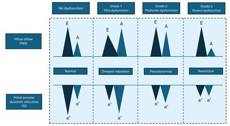 Echocardiographic Assessment of Cardiac Function in Mouse Models of ...
