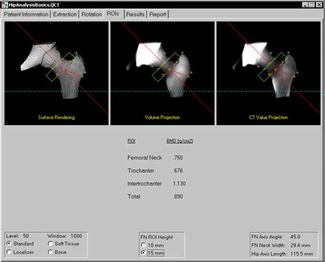 QCT 5 Pro Video Tutorials 的图像结果