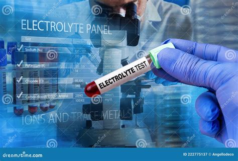What Is An Electrolyte Panel Blood Test at Barbara Ridgley blog