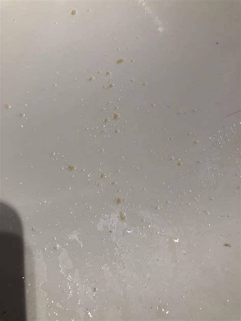 Why Do I Have White Spots In My Urine at Callum Grenda blog