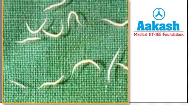 Phylum Aschelminthes: Examples, Characteristics & Classification | AESL