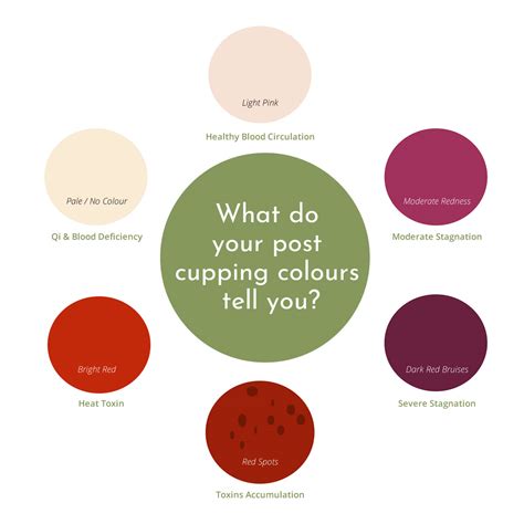 Chinese Cupping Chart at Samuel Unwin blog