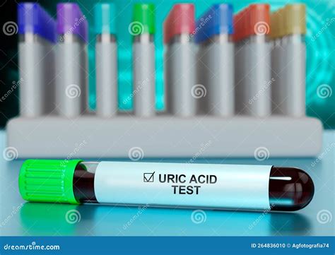 Human Blood Sample in the Tube for Testing Uric Acid Levels Stock Illustration - Illustration of ...