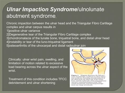 Hand and fore arm radiology truma girish gunar | PPTX