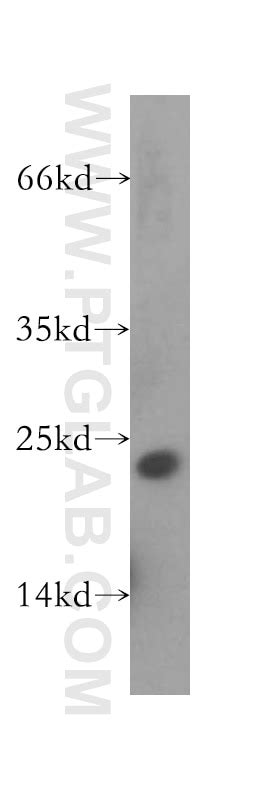 RAB31-specific antibody (16182-1-AP) | Proteintech