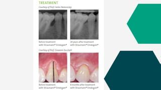 Host Modulation Therapy 的图像结果