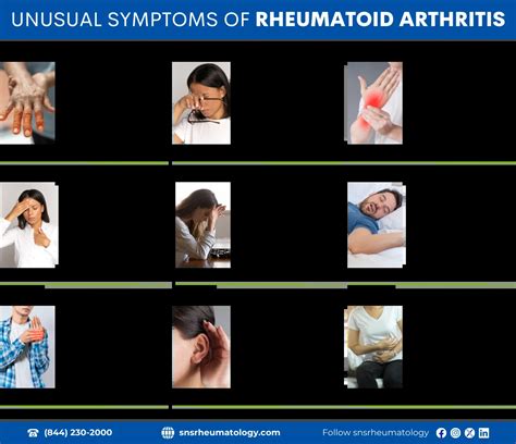 Early Rheumatoid Arthritis Symptoms Rheumatoid Arthritis Physiopedia
