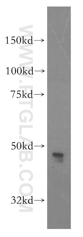 CADM1 antibody (14335-1-AP) | Proteintech