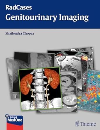 Buy Genitourinary Imaging: RadCases Book Online at Low Prices in India ...